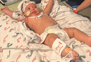 Berthoud family’s baby Anakin faces a medical mystery
